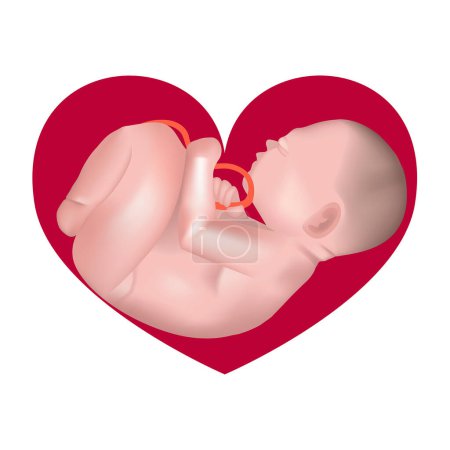 Téléchargez les illustrations : Embryon au milieu du cœur. Bébé dans le ventre. Icône sur le thème de la maternité - en licence libre de droit