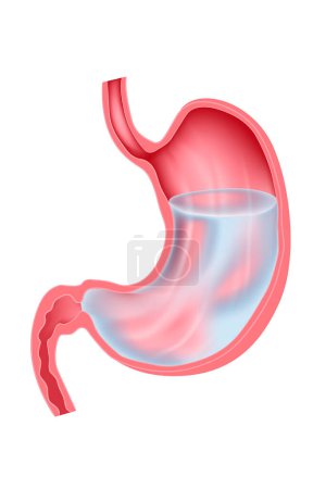 ein menschlicher Magen, gefüllt mit klarer Flüssigkeit. Verdauungssystem. Medizinische Illustration der Anatomie eines inneren Organs im Schnitt. Vektor.