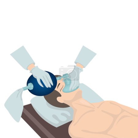 Illustration for Artificial ventilation of the lungs using an ambu bag. Vector flat illustration - Royalty Free Image