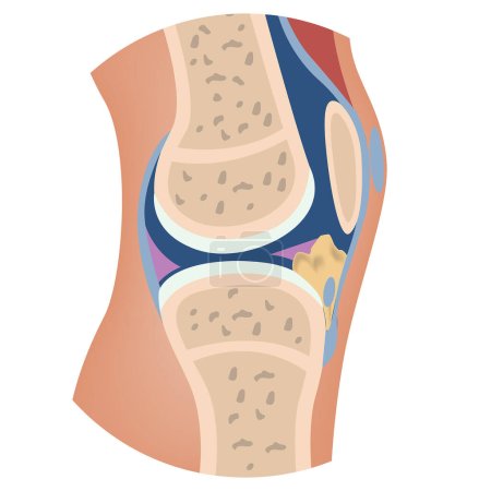 Illustration for The structure of the human knee. Cross-sectional anatomy of bones. Medical vector illustration - Royalty Free Image