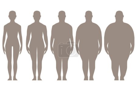Illustration for Stages of obesity, the process of obesity. Silhouette of a man with a gradual set of overweight - Royalty Free Image