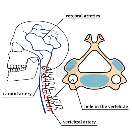 Illustration for The contour of the skull with the spine. Infographic with vertebral artery syndrome. Medical poster. Vector illustration - Royalty Free Image
