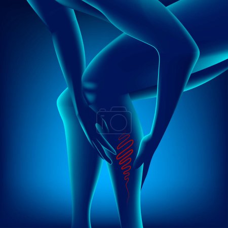 Illustration for Human legs with varicose veins. Neon, glowing illustration. medical poster - Royalty Free Image