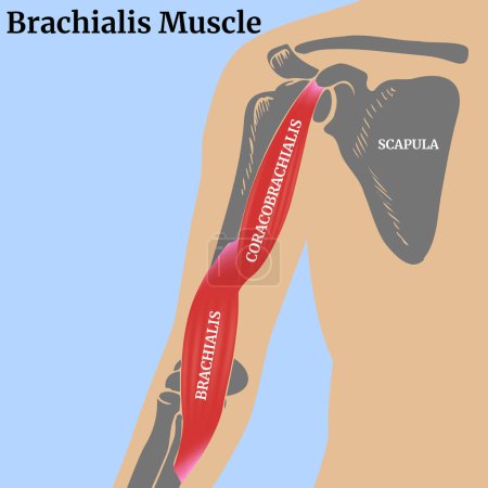 Brachialmuskulatur. Medizinisches Poster mit einem menschlichen Oberkörper und Knochen des Schultergürtels. Vektorillustration