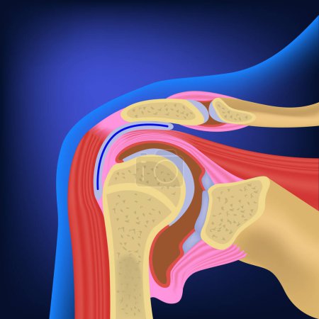 Illustration for Anatomical structure of the shoulder joint and its muscles. Medical poster on a blue background. Vector illustration - Royalty Free Image