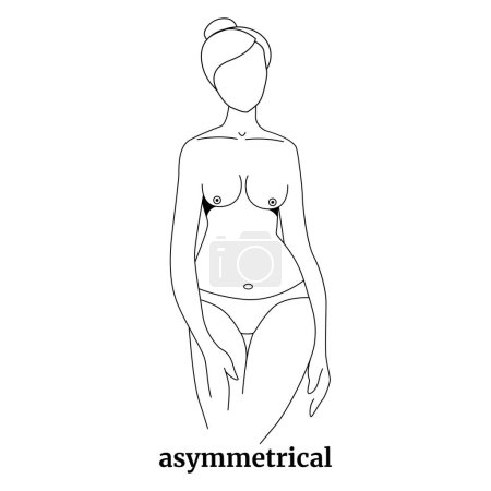 Illustration for Types of woman breast shapes. Asymmetrical shape. Silhouette of a girl with black line. Vector illustration. - Royalty Free Image