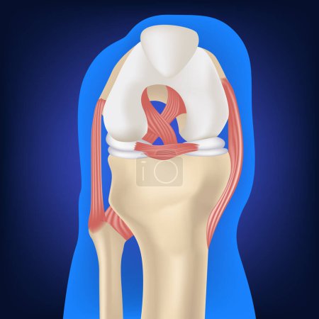 Illustration for Cruciate ligament, leg bones on a blue background. The structure of the knee joint. Medical design. Vector illustration. - Royalty Free Image
