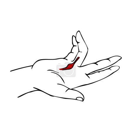Dupuytren's contracture. Damage to ligaments in the hand. Minimalistic scheme with simple black lines. Isolated vector illustration