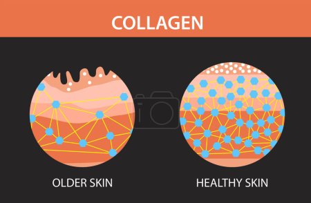 Ilustración de Colágeno, piel vieja y piel dura, Protección de la piel, diseño de vectores - Imagen libre de derechos