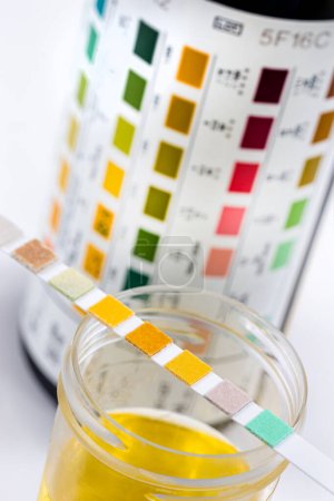 Strip placed on the urine bottle