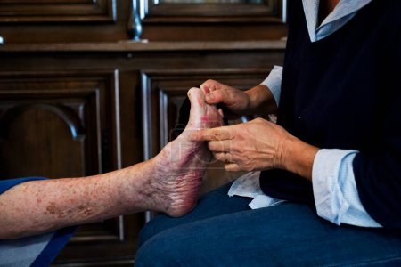 Téléchargez les photos : Infirmière libérale visitant une personne âgée. Soins des jambes et des petites blessures. - en image libre de droit