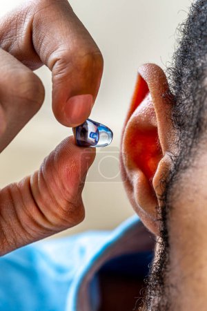 Photo for Close-up on the positioning of a digital hearing aid in a young man. - Royalty Free Image