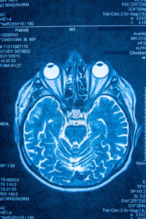 Tomographie des Gehirns durch Scanner.