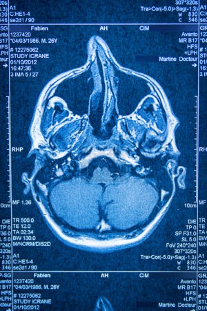 Tomographie des Gehirns durch Scanner.