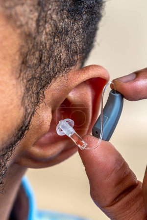 Photo for Close-up of the installation of the prosthesis in the ear of a young man. - Royalty Free Image