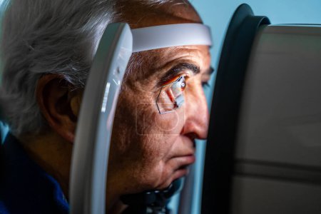 Nahaufnahme eines ernsten älteren Mannes mit Augenöffner, der während einer Laserbehandlung bei Glaukom durch eine innovative Maschine schaut
