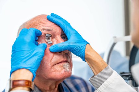 Augenarzt, der einem älteren Patienten vor einer innovativen Behandlung des Glaukoms einen Augenöffner anwendet