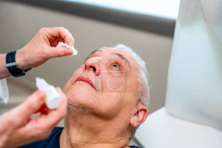 Oftalmólogo aplica gotas para dilatar la pupila a un hombre antes de una prueba de glaucoma en el ojo con una máquina láser