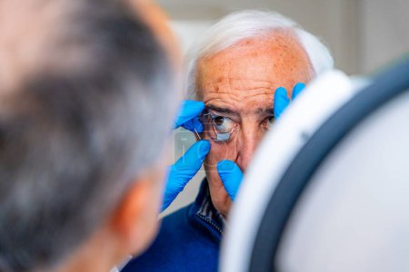 Augenarzt setzt einem älteren Mann einen Augenöffner auf, um ihn auf eine Laserbehandlung bei Glaukom vorzubereiten