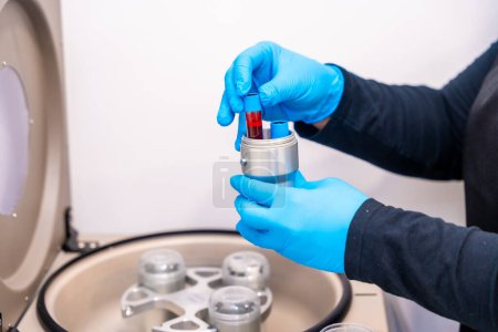 Expertise placing blood samples in vials on a centrifuge machine in a beauty clinic for baldness treatment
