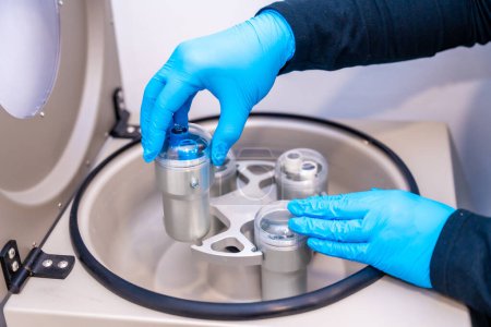 Close-up top view of the hands of a dermatology lab health worker placing test tubes with blood samples in centrifuge