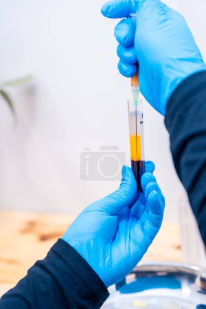 Vertikales Foto der Hände einer Krankenschwester, die zentrifugiertes Blut mit einer Spritze extrahiert, um es in eine Kahlheitsbehandlung zu injizieren