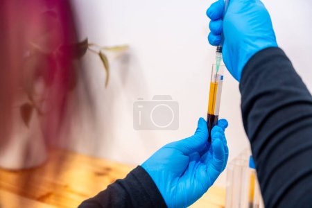 Close-up rear view of a woman in blue gloves extracting blood from tube sample in a dermatology lab for a baldness treatment