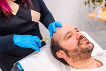 Man receiving a mesotherapy treatment for Hair Loss injecting blood in the area in a clinic