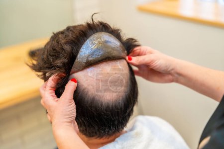 Peluquería en una clínica capilar especializada ayuda a un cliente masculino con alopecia mediante la aplicación de una pieza de pelo con pegatinas adhesivas