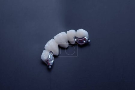 Photo for Close up tooth model / mock tooth in dental clinic Dental care and dentist 's equipment concept - Royalty Free Image