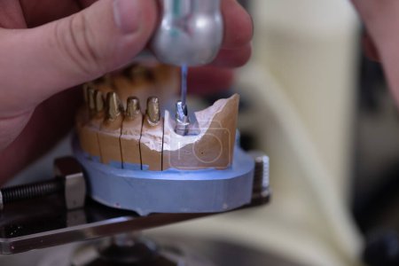 Foto de Técnico dental que trabaja con prótesis dental en laboratorio de prótesis - Imagen libre de derechos