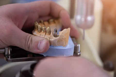 Téléchargez les photos : Technicien dentaire travaillant avec une prothèse dentaire au laboratoire de prothèse - en image libre de droit