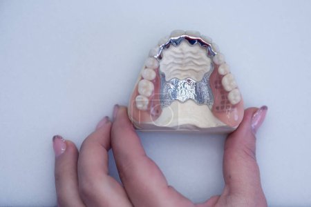 Photo for Dental teeth dentists model. Models of human jaws in an orthodontic clinic - Royalty Free Image