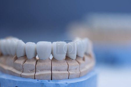 Foto de Modelo de dentistas dentales. Modelos de mandíbulas humanas en una clínica de ortodoncia - Imagen libre de derechos