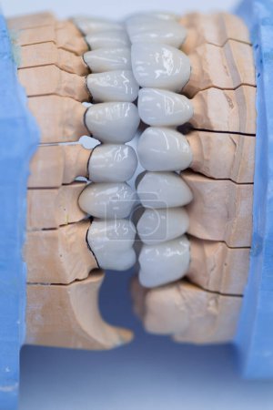 Téléchargez les photos : Dents dentaires modèle dentistes. Modèles de mâchoires humaines dans une clinique d'orthodontie - en image libre de droit