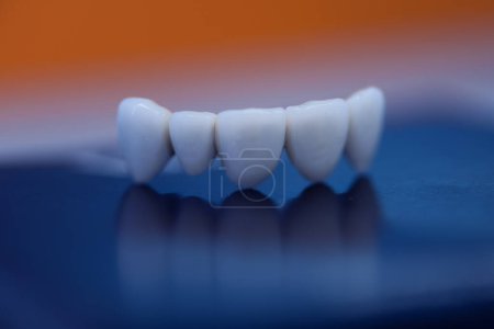 Téléchargez les photos : Dents dentaires modèle dentistes. Modèles de mâchoires humaines dans une clinique d'orthodontie - en image libre de droit