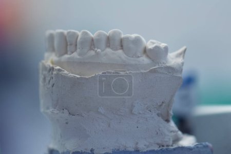Foto de Modelo de dentistas dentales. Modelos de mandíbulas humanas en una clínica de ortodoncia - Imagen libre de derechos