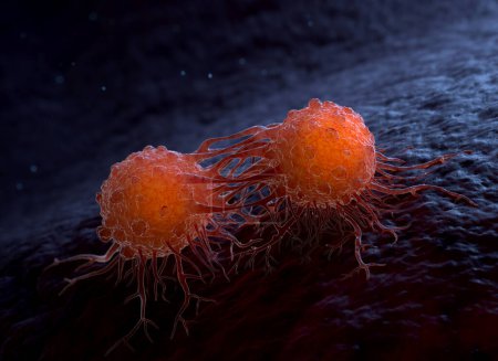 Cancer cells can migrate to other body tissues or organs building metastasis. 3D illustration