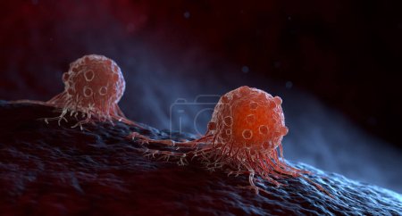 Les cellules cancéreuses peuvent migrer vers d'autres tissus ou organes du corps construisant des métastases. Illustration 3D