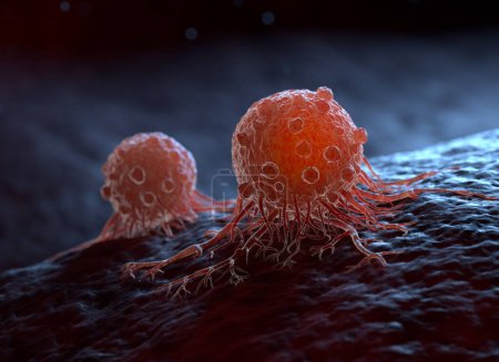 Foto de Las células cancerosas pueden migrar a otros tejidos u órganos corporales que producen metástasis. Ilustración 3D - Imagen libre de derechos