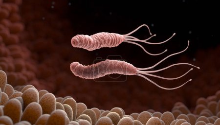 Helicobacter Pylori es una bacteria gramnegativa microaerofílica que se encuentra en el estómago. Ilustración 3D