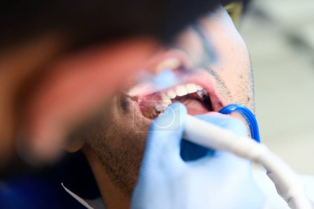 Téléchargez les photos : Procédure de blanchiment dentaire expert en cours - en image libre de droit