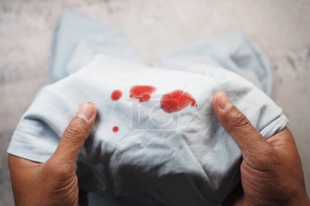 Téléchargez les photos : Taches de sang sur une chemise blanche - en image libre de droit
