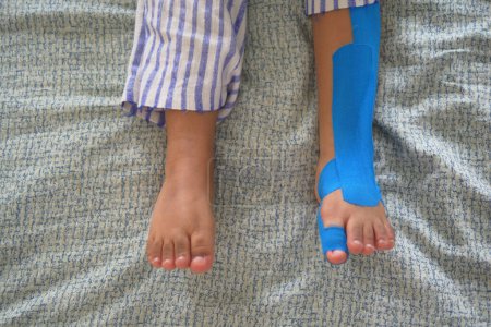 Elastic therapeutic blue tape applied to child leg. Kinesio Taping therapy for injury.