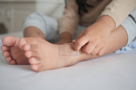 un enfant souffrant de démangeaisons cutanées sur les pieds .