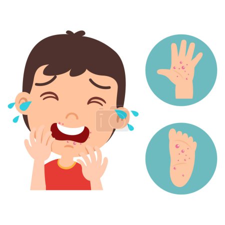 Kid boy is hand foot mouth disease concept design of vector illustration