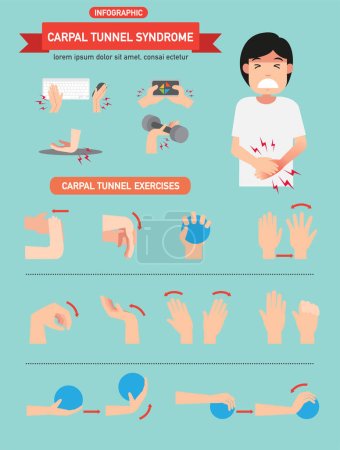 Illustration for Carpal tunnel syndrome infographic vector illustration. - Royalty Free Image