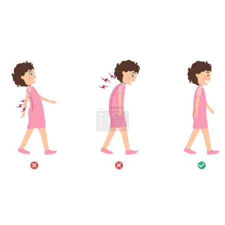 Illustration for Wrong and correct walking posture,illustration,vector - Royalty Free Image
