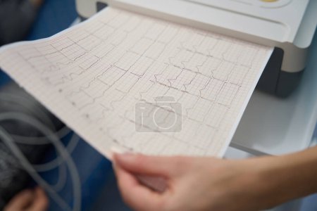 Foto de La mano femenina sostiene una hoja de papel en la que se muestra el trabajo del corazón del paciente. - Imagen libre de derechos