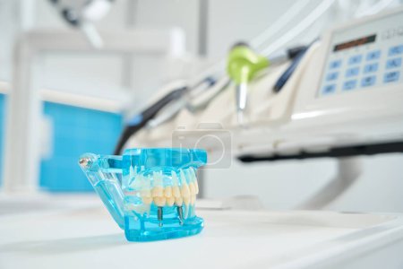 Téléchargez les photos : Gros plan du modèle de dents de démonstration transparentes bleues apposées sur la table du plateau de l'appareil dentaire - en image libre de droit